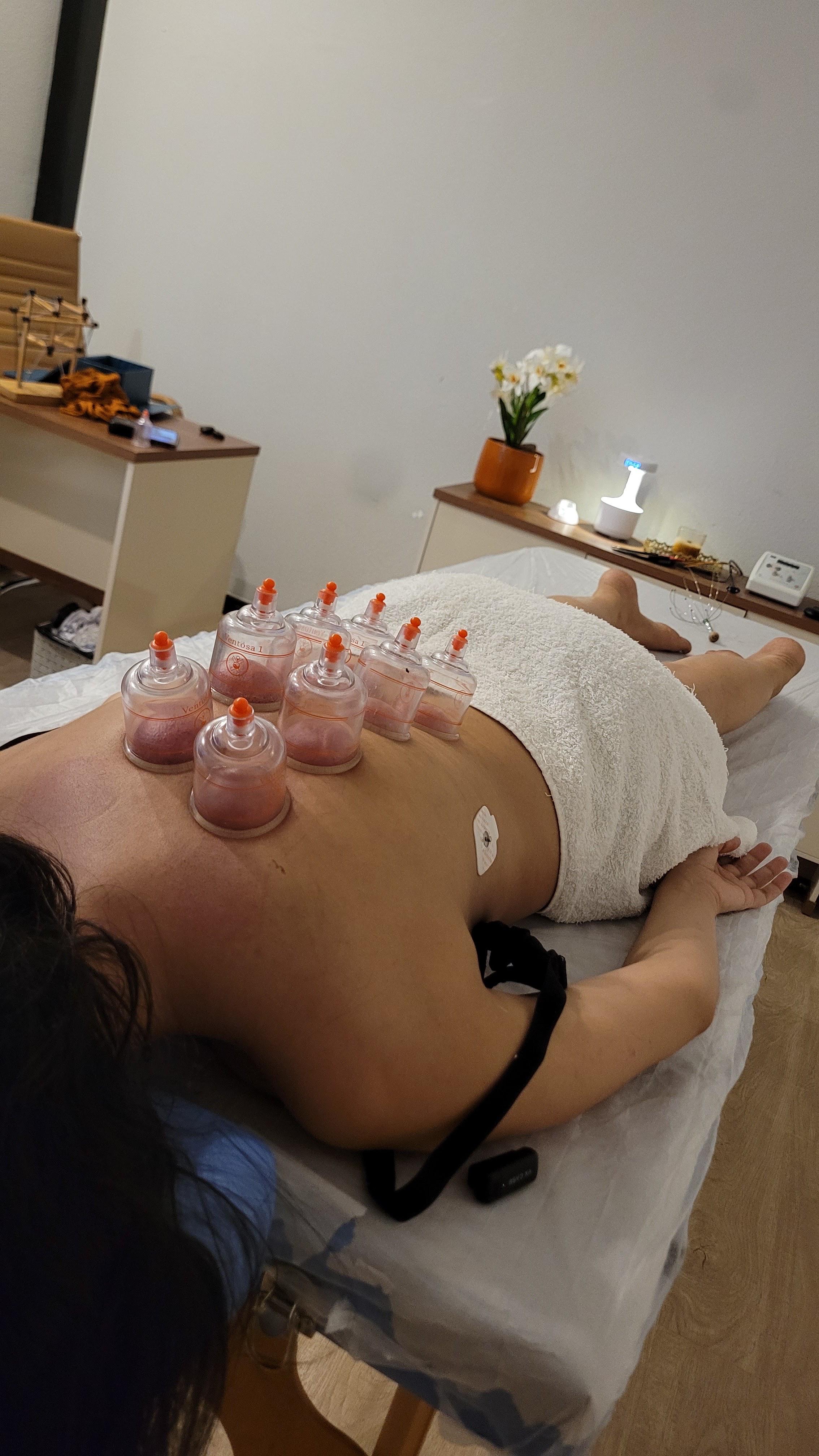 Registro real de ventosaterapia na maca